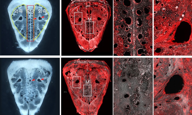 First gateway for brain waste removal identified in world first