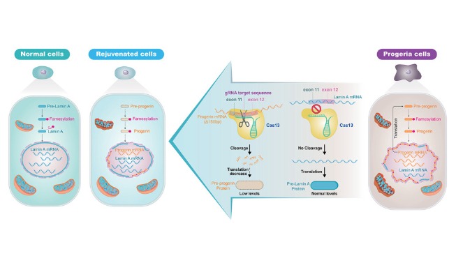 World-first method removes gene from rapidly aging disease